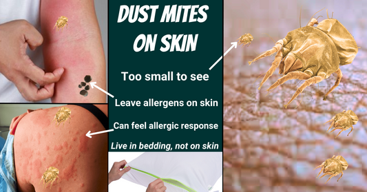 Dust Mites On Skin and How To Get Rid Of Them