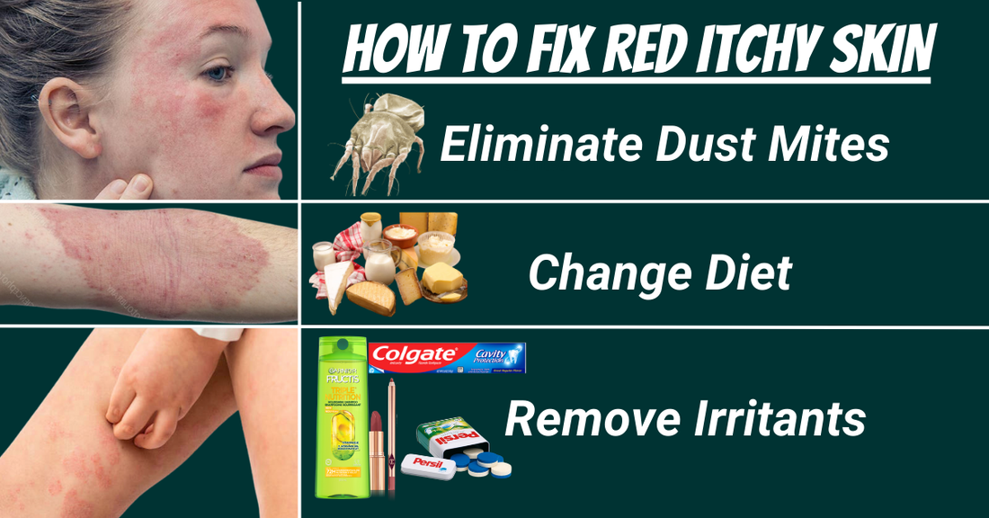 Whats Causing Your Red Itchy Skin