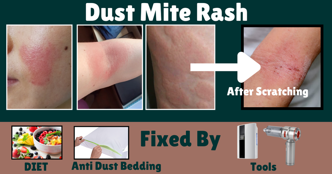 How to Know If You Have Dust Mites