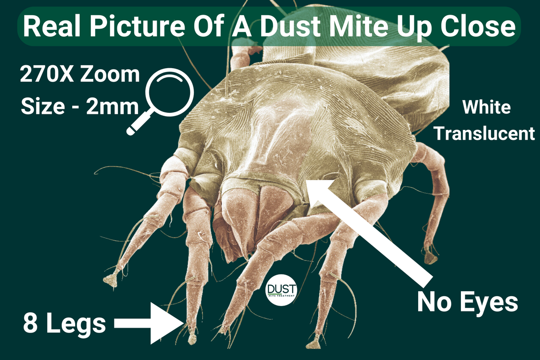 What Does A Dust Mite Look Like? Up Close