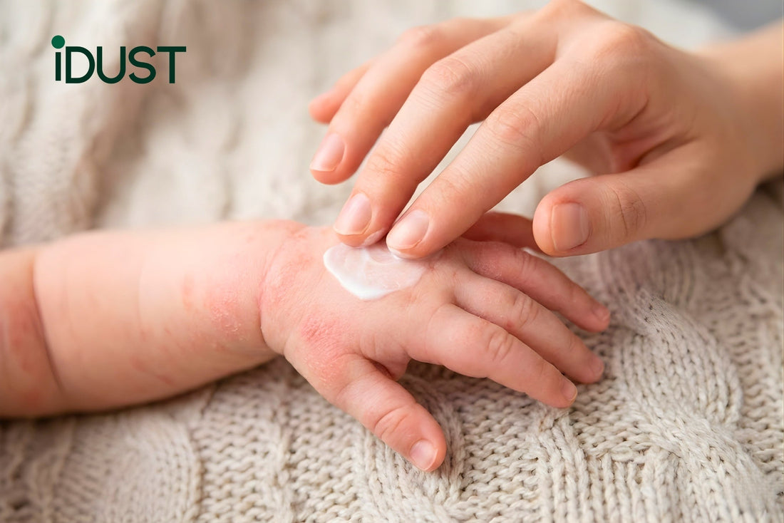A parent applying lotion to treat stubborn baby eczema symptoms, illustrating the persistent struggle addressed in this guide about identifying and eliminating underlying dust mite triggers in the nursery environment.