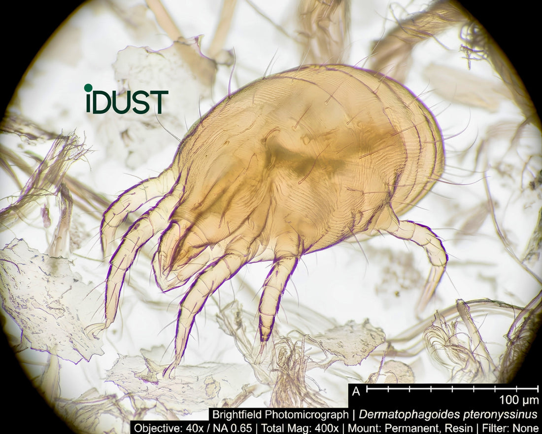 House dust mites and allergen debris magnified under a microscope, showing the colony living inside an aging mattress