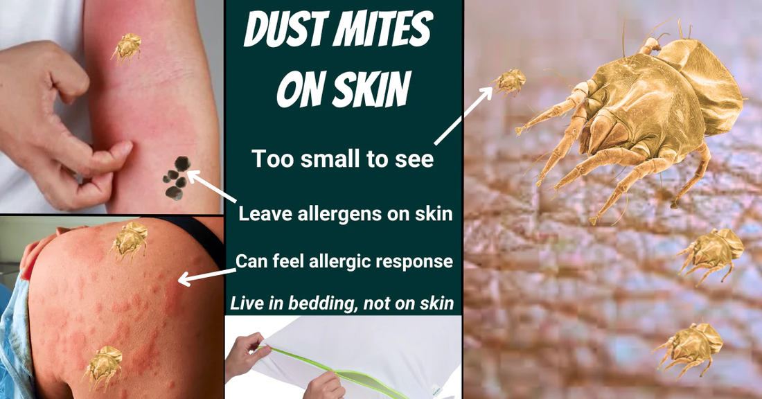 Infographic showing red itchy rash from dust mites on skin and explaining that mites live in bedding, not on humans.