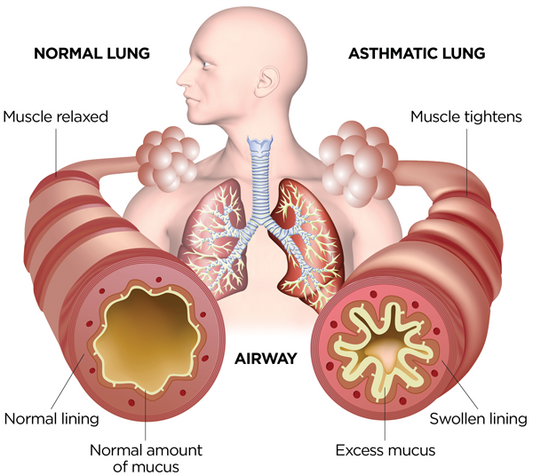 How Dust Mites Cause Allergies