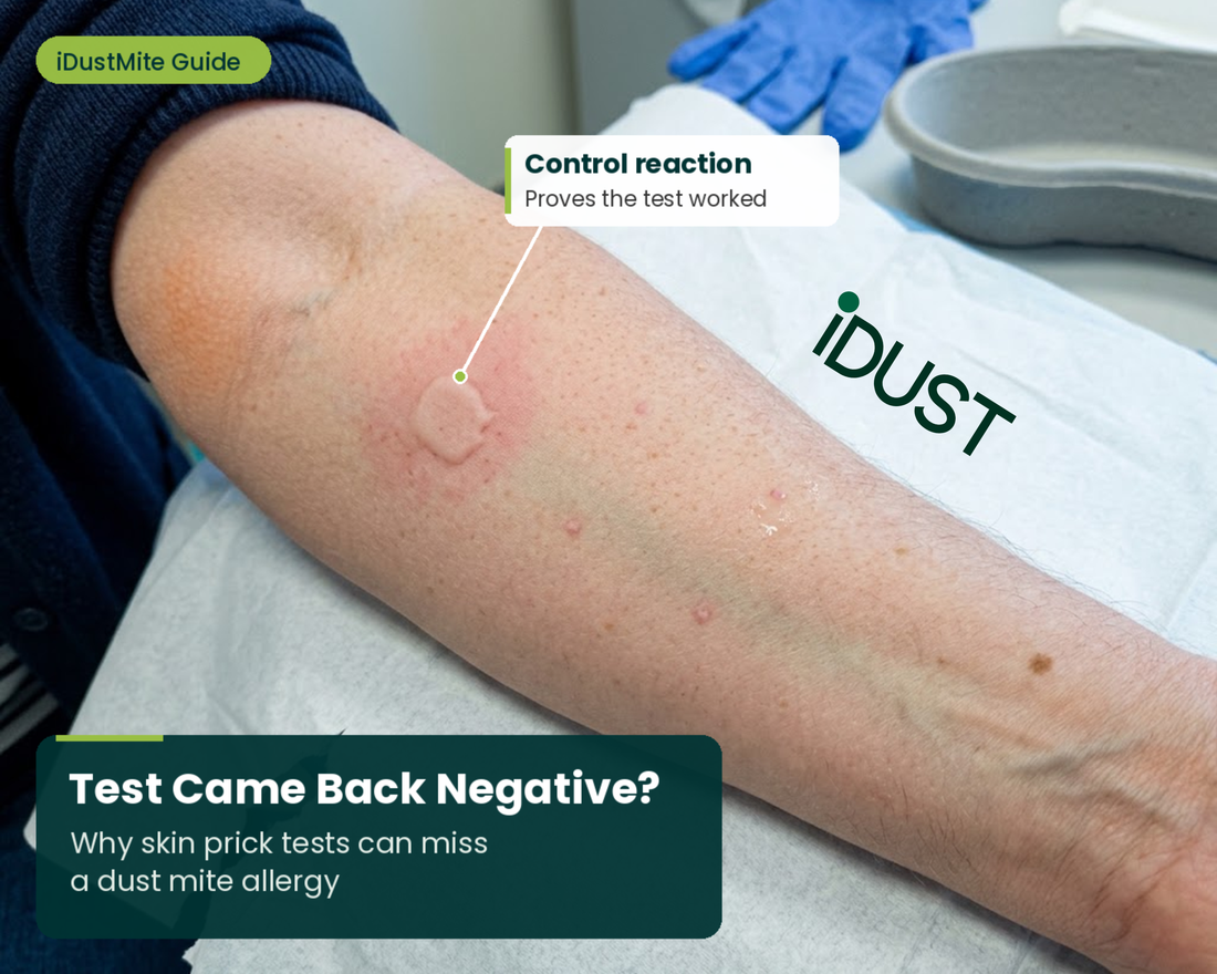 Skin Prick Test Negative but Still Allergic to Dust Mites? Why Tests Can Miss It