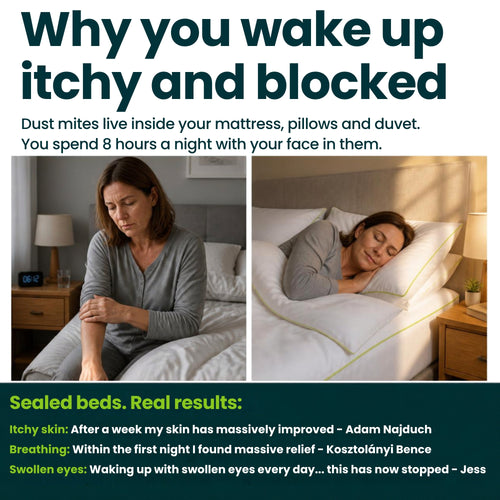 Woman waking itchy and blocked from dust mite allergy, then sleeping peacefully on a bed sealed with iDustMite protectors